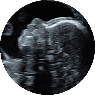 iperixografima-v-epipedou-proswpo3